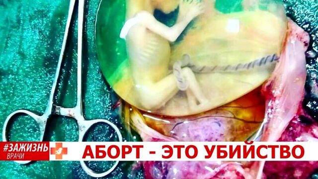 Украина гинеколог порно видео на grantafl.ru